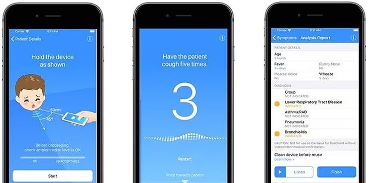 ResApp: A phone app that can detect COVID-19