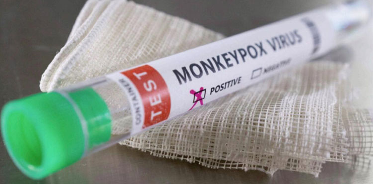 US preparing to deploy monkeypox vaccines amid more probable cases