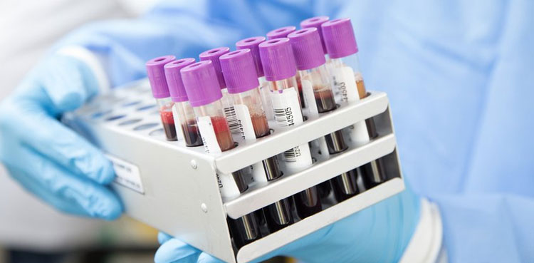 228 probable unexplained cases of child hepatitis: WHO