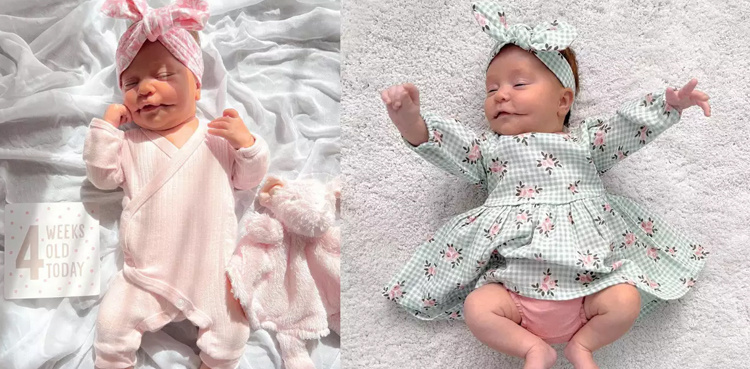 Baby born with 'permanent smile' due to rare condition