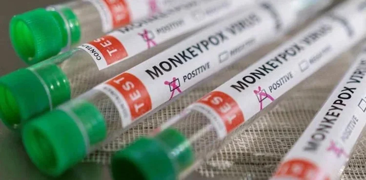 NIH confirms third monkeypox case in Pakistan