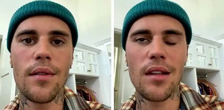 Justin Bieber asks for prayers as he suffers facial paralysis