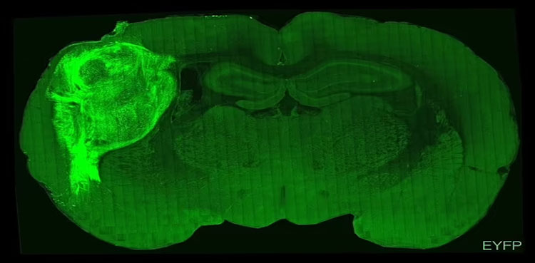 Stanford scientists create hybrid brain using rat and human cells