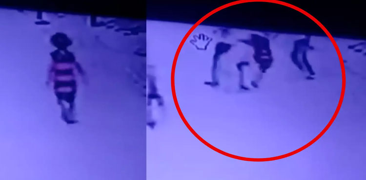 WATCH: Pitbull dog attacks 9-year-old girl