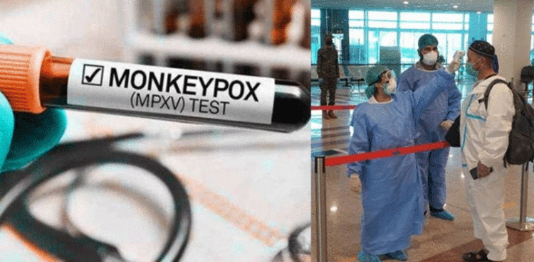Two monkeypox suspects shifted to isolation center in Karachi