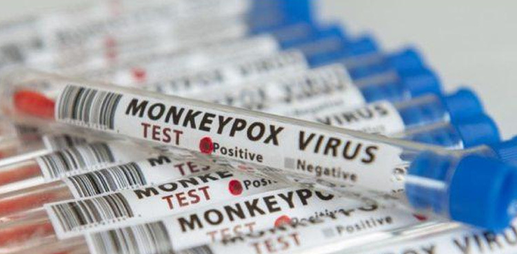 Karachi reports first case of monkeypox, confirms health dept