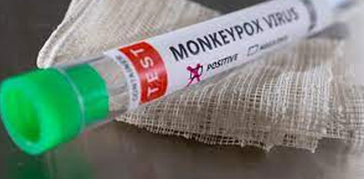 Another monkeypox case reported in Pakistan