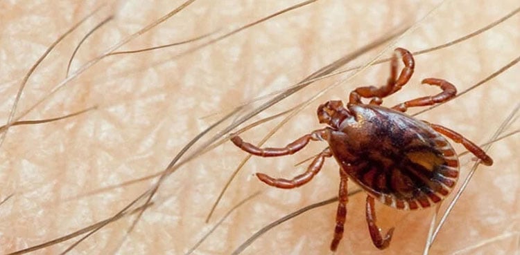 Another case of Congo virus reported in Quetta