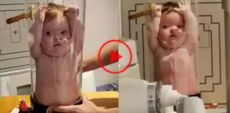 Watch: Baby gets X-ray taken in glass tube