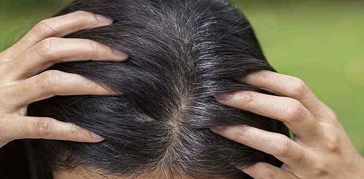 Facing hair fall, premature greying? Know the causes and solutions