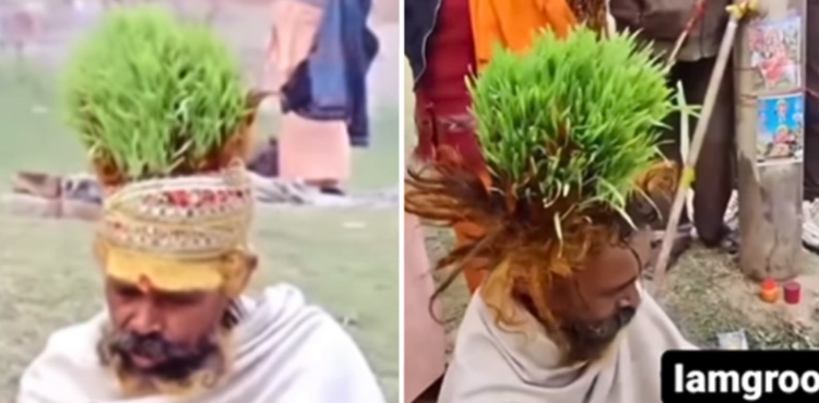 Watch: Man grows greens on his head, says roots often tear his scalp