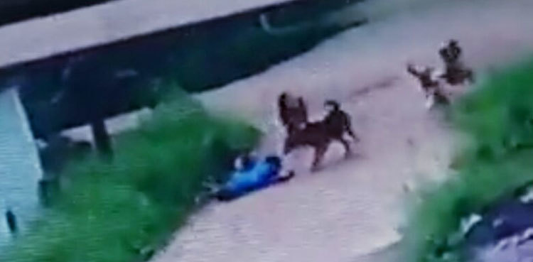 Video: Stray dogs attack minor boy