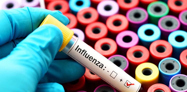 Influenza virus cases increasing in Karachi