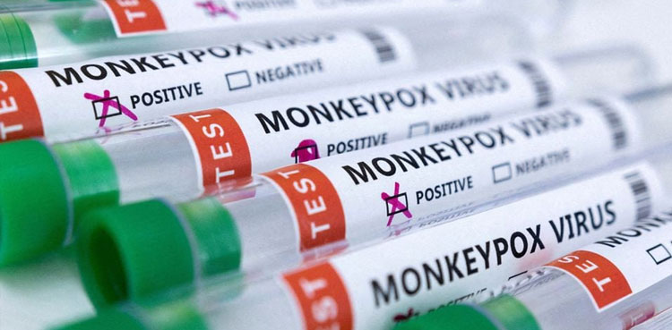 Five suspected monkeypox cases reported in Pakistan