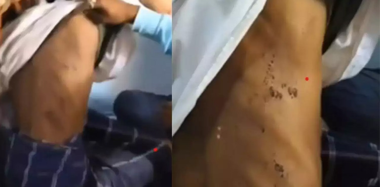 Muslim man's beard cut off with broken glass, forced to chant ‘Jai Shri Ram’