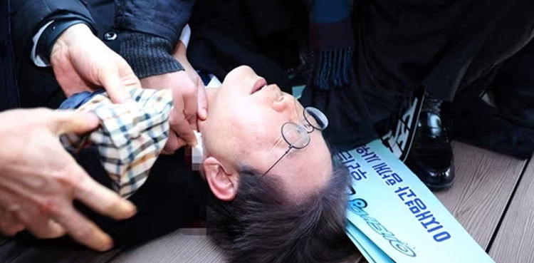 South Korean opposition leader stabbed in neck