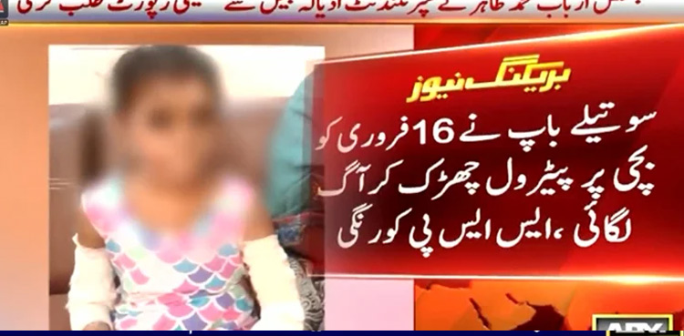 Stepfather sets eight-year-old daughter on fire in Karachi