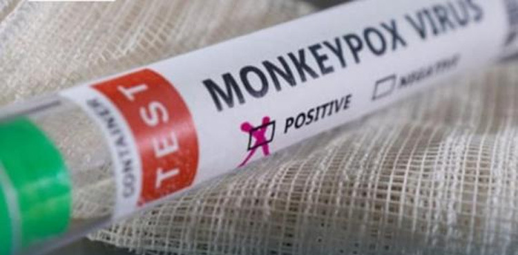 Pakistan reports another case of Monkeypox
