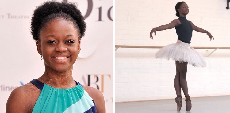 Celebrated ballerina Michaela DePrince dead at 29