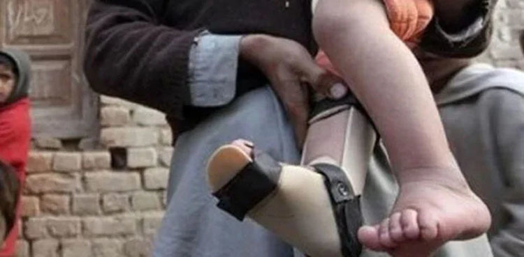 Four more polio cases reported in Pakistan, tally reaches 32