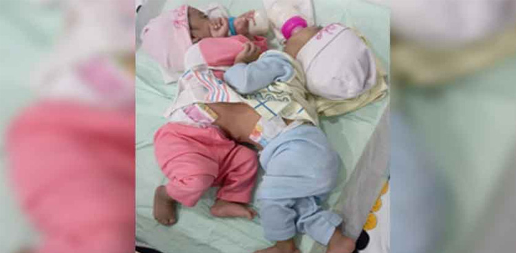 Conjoined twins separated in Karachi after 12 hours long surgery