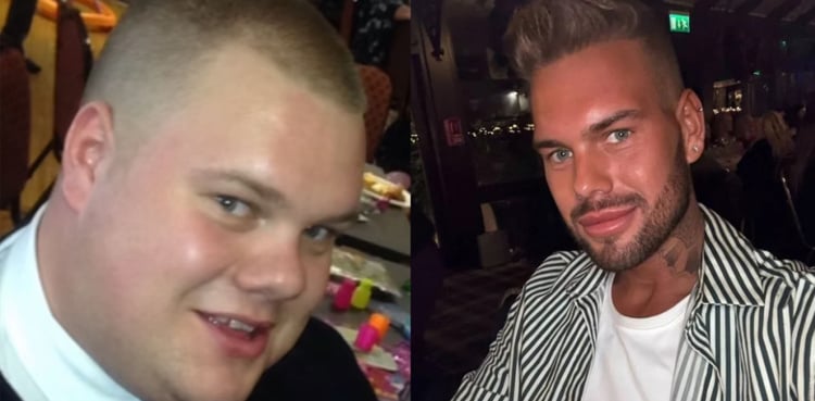 Man spends $46,000 on plastic surgeries to get ‘Instagram Filter’ look