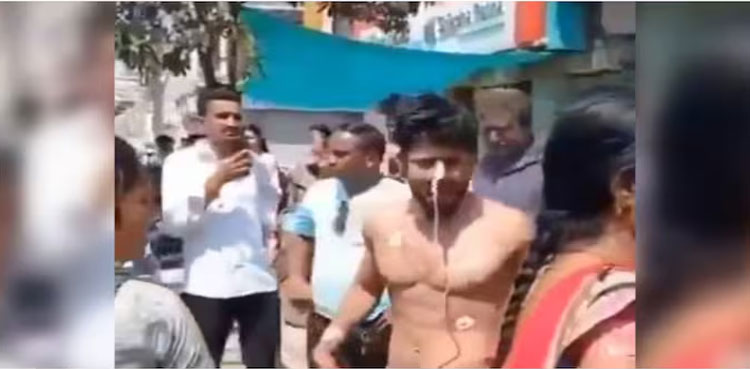 VIDEO: 'Coma' patient walks out of ICU