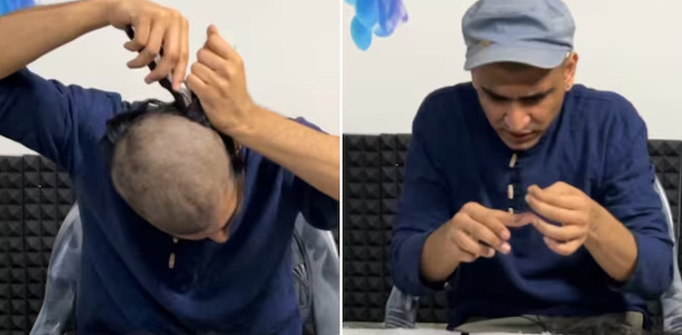Man’s viral hair-counting mission has internet laughing out loud