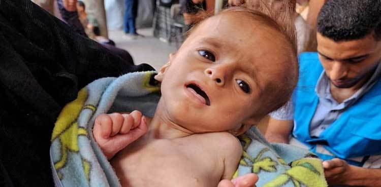 NGO says starving Gaza children too weak to cry