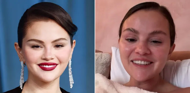 Selena Gomez turns blunt ‘Mustache’ remark into skin health awareness