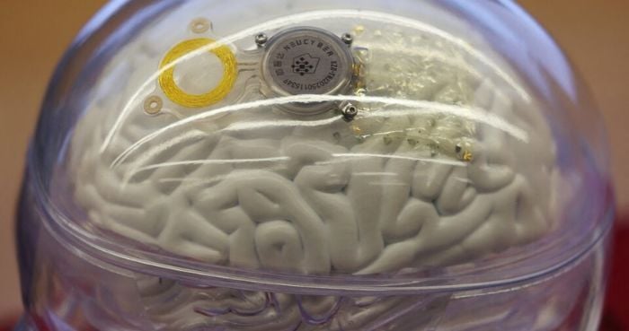 Beijing-backed brain chip firm says it is 3 years behind Musk's Neuralink