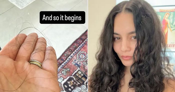Vanessa Hudgens gets honest about hair loss after second baby