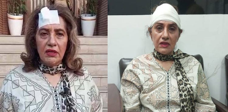 Uzma Kardar severely injured during gym workout