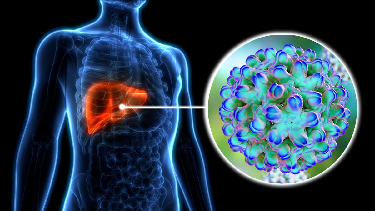 Pakistan moves closer to introducing breakthrough therapy for Hepatitis Delta