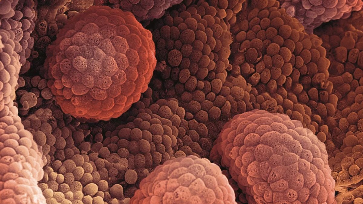 Prostate cancer drug shows promise in halting tumour growth and spread