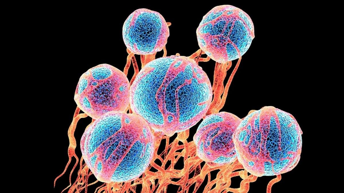 Ovarian cancer spread linked to common dietary sugar in groundbreaking new study