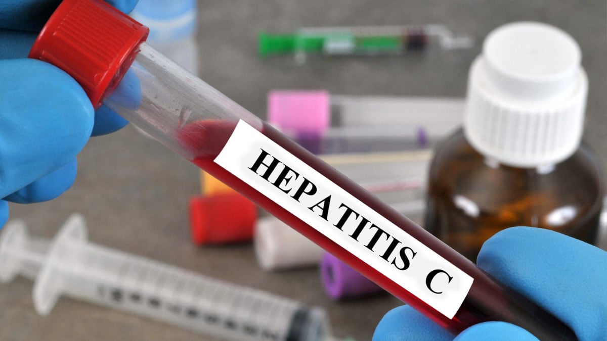 Government launches hepatitis screening programme for employees